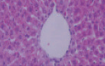 정상생활을 한 쥐의 간